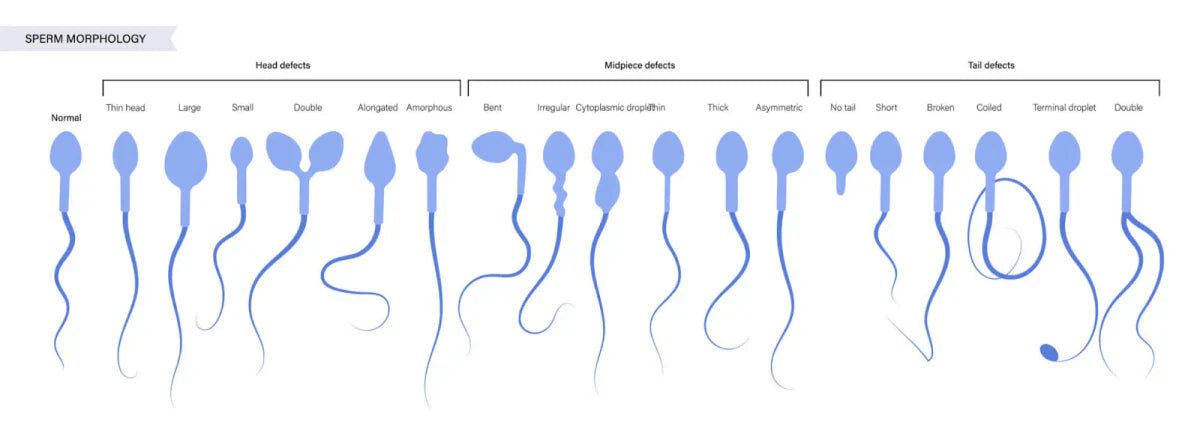 Morfologa de los espermatozoides y fertilidad | Conceive Plus Morfologa de los espermatozoides y fertilidad | Conceive Plus