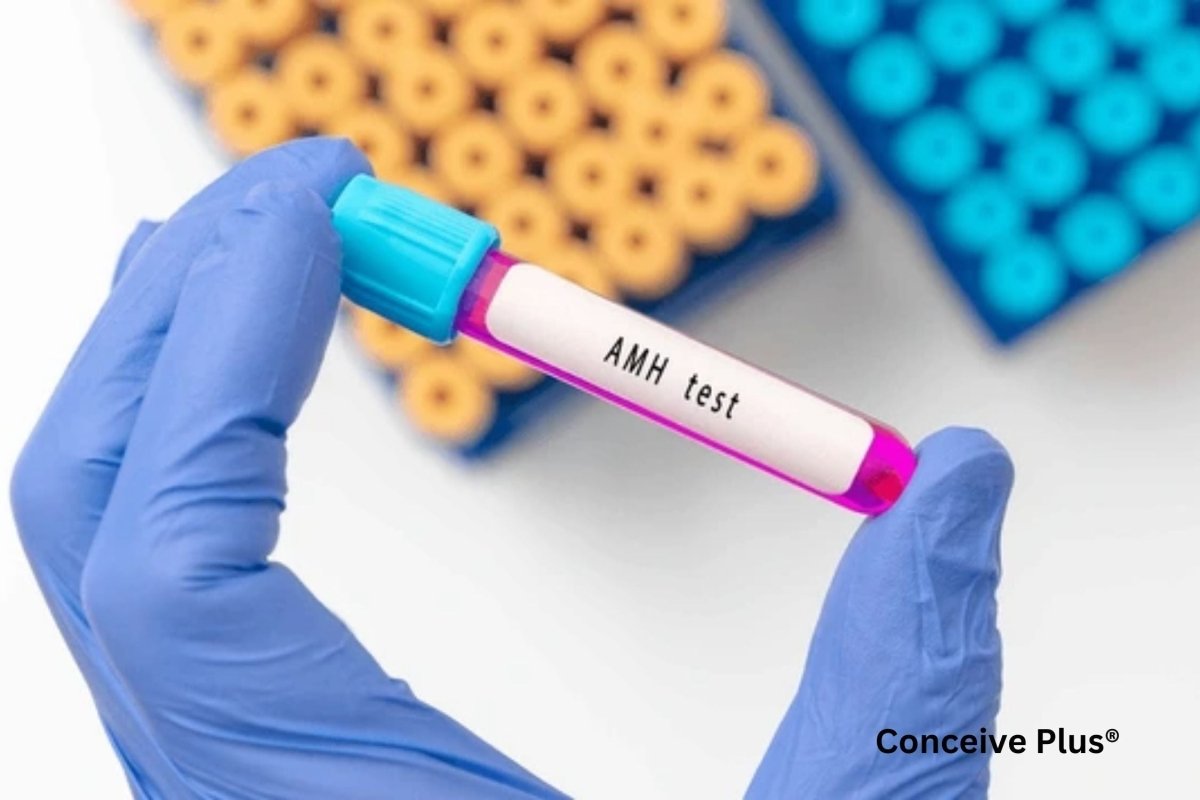 AMH Hormone Test Cost: Fertility Assessment | Conceive Plus®