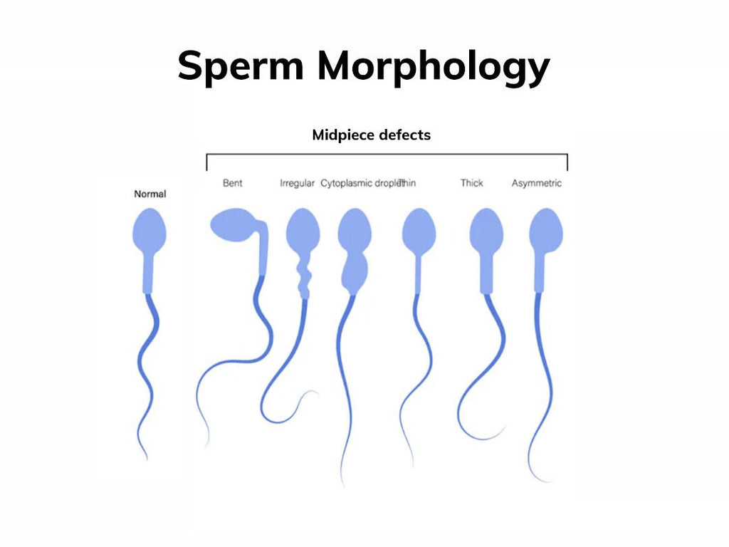 How Sperm in Egg Leads to Fertilization | Conceive Plus®, image size:1024x768