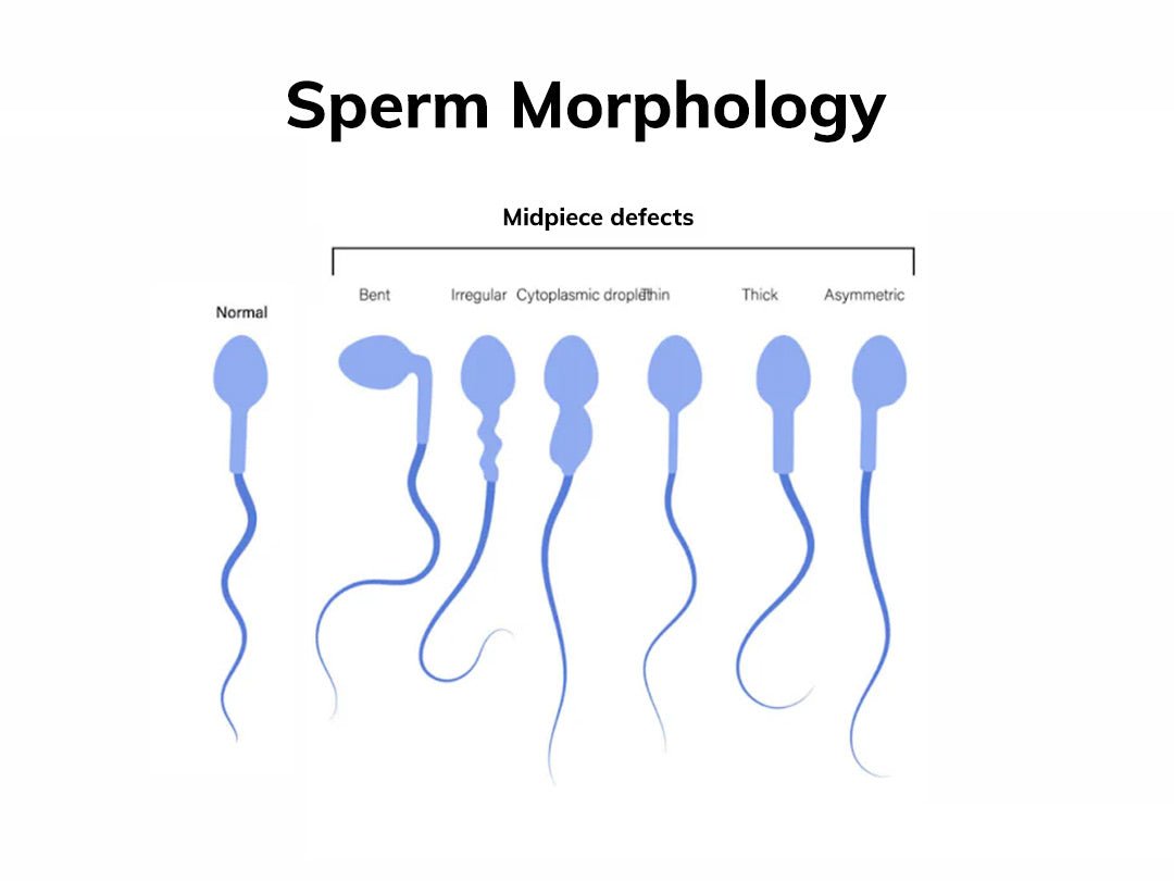 How Sperm in Egg Leads to Fertilization and the Journey of Sperm and Egg Cells - Conceive Plus®