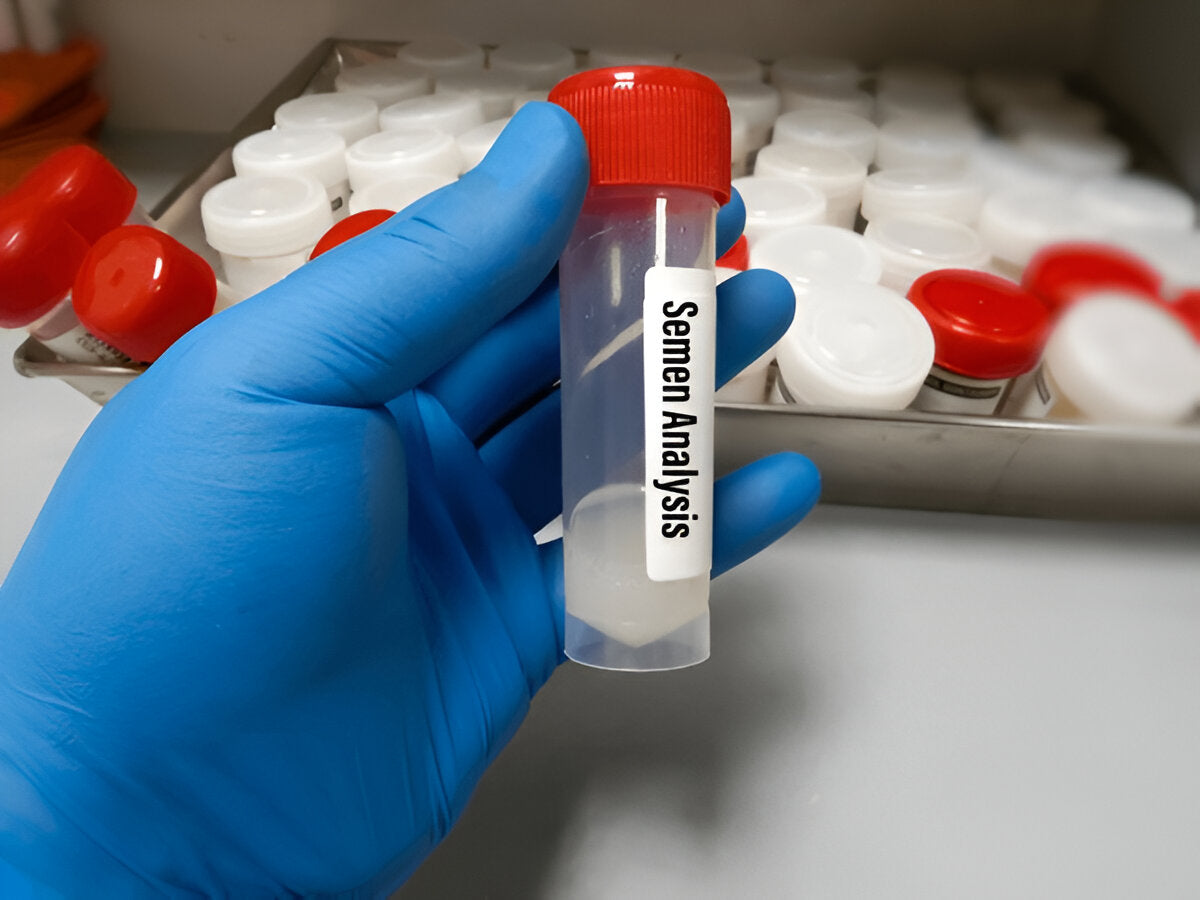 infertile seminal fluid the image showing semen sample for analysis to determine if it is an infertile seminal fluid